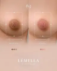 韓国No.1シェア【メラニン除去ケア】 バストトップ*アフタークリーム1個(¥17,000)付き