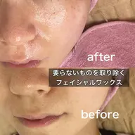 限定残り2名様ツヤ、ピカ✨️内側から発光するお肌へ～美肌wax＆LEDライト*お写真モデル