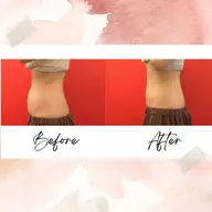 【ダイエット/ポッコリお腹に🙉】美腸マッサージ40分＋蒸気温熱10分\8,000