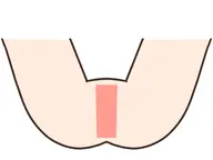 【レディース】VIO選べる部位ワックス脱毛『I』/はみ毛防止・完全ノーヘアデザイン可能！毛量により割引き制度あり◎