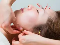 【美容鍼+矯正】『小顔鍼』お試し