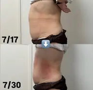 初回 お好きな箇所4カップ(お腹腰周り、背中、太もも周りを早くサイズダウンしたい方におすすめ)