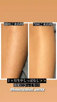 woman 全身脱毛(顔・vio込)