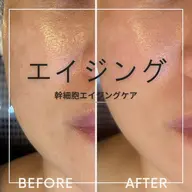 6,000円 幹細胞エイジングケア ハリツヤup！