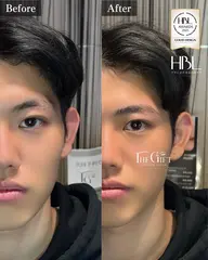 HBL(ハリウッドブロウリフト)＋眉毛ワックス脱毛