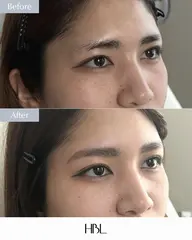 【学割🎀あと1名限定】垢抜け！美眉フルコース✨HBLフル施術＜✔️条件あり＞