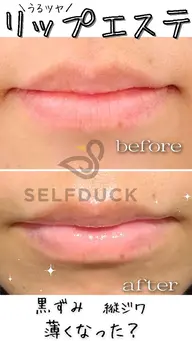 💋歯科衛生士の本格うるツヤリップエステ💋