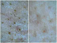 黒ずみ毛穴管理💊鼻脱毛(小鼻)＋ハイドラ毛穴洗浄(鼻筋、小鼻)¥5,500