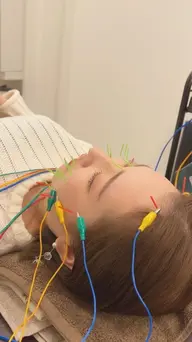 【顔も身体も鍼がしたい方】美容鍼灸➕鍼灸で美と健康を同時に!