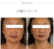 瞬間小顔。食いしばりや頭痛、首肩コリなど、不調を取り除く。あっという間の変化をぜひご体感くださいませ。