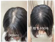 ナチュラルコース　増毛400本