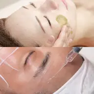 【ミニモ限定🫧肌質改善×リフトアップしたい方❤️】剥離なしハーブピーリング＋溶ける糸リフトパック🫶🏻