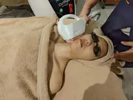 【産毛も◎トーンUP◎】スピート顔脱毛（眉上/眉間込み）　6600円