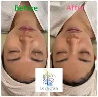 リフトアップコース