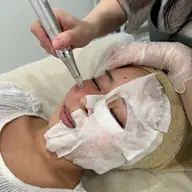 【毛穴にはコレ！】ソフトダーマペン