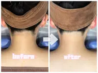 効果実感IPLうなじ脱毛🌙✨安心の実績40年の老舗✨初めての方大歓迎✨二段階シェービング付🌙✨ワックス・剃刀卒業🌙