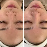 💚黒ずみくすみ改善【クリスティーナ 剥けないハーブピーリング】💚