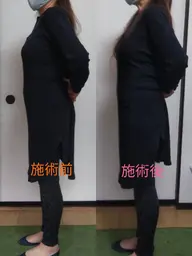 ポッコリお腹サヨナラ整体