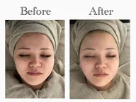 ⭕️半額⭕️(60分)うる艶ジェルパック➕フェイシャルマッサージ【小顔/浮腫み/乾燥/潤い】➕ソフトシェービング産毛ケア