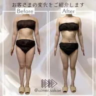 【全身+デコルテ】 ハイパーナイフ+リンパマッサージ90分