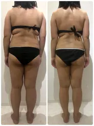 下半身痩身初回