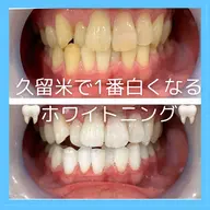 メディカルホワイトニング