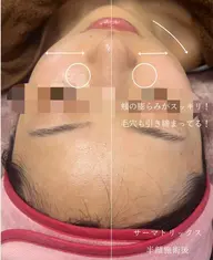 【サーマトリックス】3パーツの集中ケア❤️‍🔥