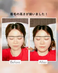 【無料/モニター募集】筋膜小顔矯正(顔の歪み/むくみ/顎のズレ)本気で改善したい!