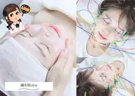 【推し活コース】美容鍼急&乳酸スノーピーリング