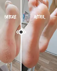 フットジェル✨(色々選べるシンプルアート)+角質ちゅるるんケア♡