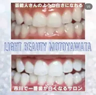 【平日限定】🦷通常お試し30分2,970円→2,470円