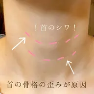 ◆学生限定◆猫背・肩こり・首痛ケア☆骨盤から整える美容整体