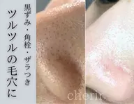 【ダブル毛穴洗浄】毛穴エクストラクション＋ハイドラ毛穴洗浄🫧毛穴黒ずみ＆詰まり改善◎