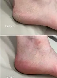 footケア🦶✨【足の角質ケア付き】