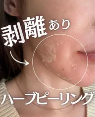【剥離ありハーブピーリング】💎古い角質をケアして透明感UP🫧