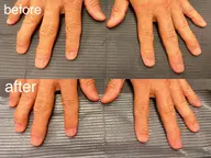 メンズネイルケア