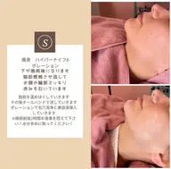 小顔ハイパーナイフ＋リンパマッサージ