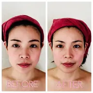 小顔効果抜群❣️ 表情筋小顔リフトアップコース♪フェイスラインすっきり!目ヂカラUP!デコルテ&首肩も。オールハンド施術