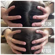 【左右差/たるみ改善】小顔矯正×頭蓋骨調整|フェイスライン引き締め💆♀️通常価格22000円 →体験価格 3300円