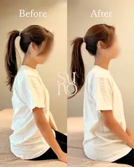 【すぐ戻る首肩こりに】｜姿勢分析＋整体 60分（本気で変えたい方）