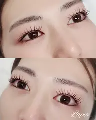 パリジェンヌリフト