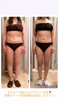 全身筋膜リリース.セルライトケア