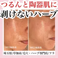 毛穴改善コース×ハーブピーリング