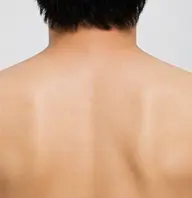 【背中脱毛】ミニモ学割🔰