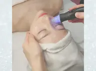 NEW🌟【CICA由来VPDRN×最先端のレスキュー美容液導入付】毛穴洗浄ハイドロfacial🫧