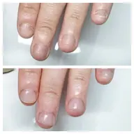 【明日限定】職場・学校OK🙆‍♀️｜バレない深爪矯正（長さ出し＋クリア）マット可