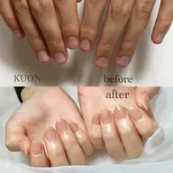 口コミ割引🉐オフ無し深爪矯正【スカルプネイル】深爪さんのお爪を自然に細長く形成!ワンカラーorグラデーション
