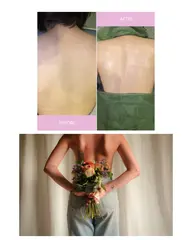 剥離なし！！背中ハーブピーリング🌿夏までに魅せれる背中✨