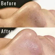 美眉waxスタイリング(カット込)＋鼻単体毛穴洗浄