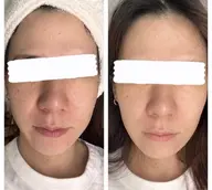 ヒト幹細胞導入コース